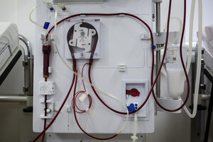 Eine Dialysemaschine. Durch dünne Schläuche fließt Blut