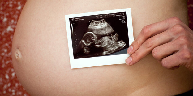 Ein Schwangerschaftsbauch. Davor hält eine Hand ein Ultraschallbild