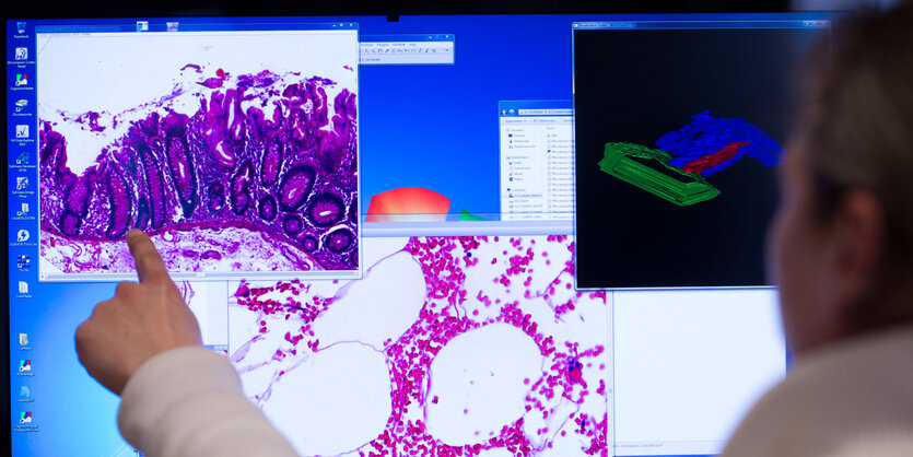 Mann zeigt auf Computerbild mit Gewebeprobe