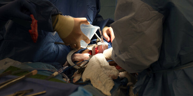 Blick auf eine Organtransplantation