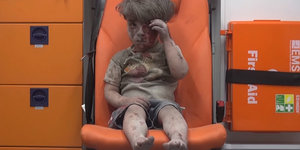 ein mit Staub bedeckter und blutverschmierter Junge sitzt in einem Notarztwagen und fasst sich an den Kopf
