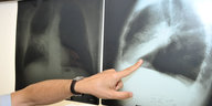 Jemand zeigt mit dem Finger auf ein Röntgenbild
