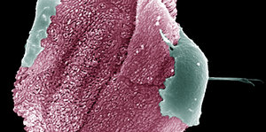 Eine Mikroskopaufnahme eines Parasiten