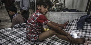 Ein blutverschmierter syrischer Junge sitzt auf einem Krankenhausbett