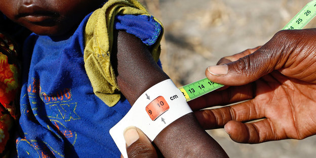 Mit einem Armband wird der Grad der Unterernährung des Kindes feststellen lässt.