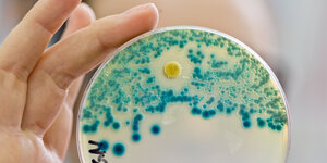 Eine Indikatorkulturplatte zum Nachweis von resistenten Bakterien in der Hand einer Labormitarbeiterin