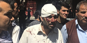 Ein Mann mit Blut im Gesicht und Kopfverband wird von anderen Männern begleitet
