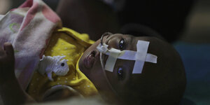 ein kleines Baby liegt, mit einem Sauerstoffschlauch in der Nase, unter einer dünnen Decke