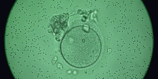 Eizellen und Spermien im Mikroskop