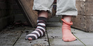 Kinderbeine in einer Hose und löchrigen Socken