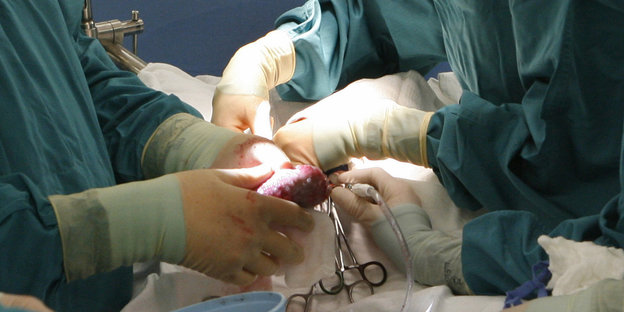 Hände, die Gummihandschuhe tragen, arbeiten an einer blutigen Niere