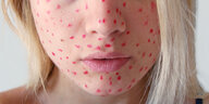 Rote Flecken sind auf ein weibliches Gesicht gemalt