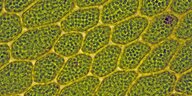 Zellstruktur eines Laubmooses: In den Zellen sind zahlreiche Chloroplasten erkennbar