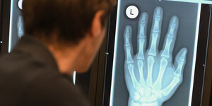 Eine Röntgenaufnahme einer menschlichen Hand