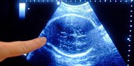 Ein Finger zeigt auf ein Ultraschallbild eines Ungeborenen