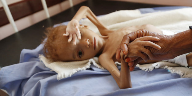 Eine Frau hält die Hand eines unterernährten Kindes in einem Krankenhaus in der Provinz Hadscha.