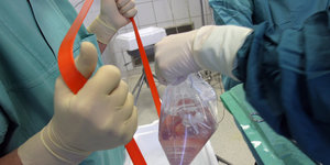 Die Händer zwei Mediziner; einer hält einen Plastibeutel mit einer Niere in der Hand.