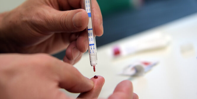 Ein junger Mann führt einen HIV-Heimtest durch