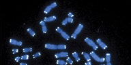 Menschliche Chromosomen blau und weiß unter dem Miksroskop