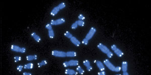 Menschliche Chromosomen blau und weiß unter dem Miksroskop