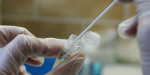 Ein Chemiker streift eine Genprobe in ein Reaktionsgefäß