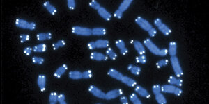 Foto von vergrößerten Chromosomen