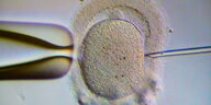 in eine Eizelle werden Spermien gespritzt