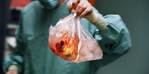ein entnommenes Herz in einem durchsichtigen Plastikbeutel von einer Person im OP-Kittel in der Hand gehalten