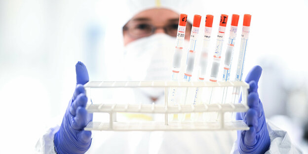 Ein Ständer mit Rachenabstrichröhrche zur Untersuchung auf Coronavirus in einem Labor