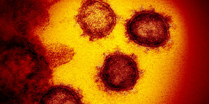 Bild des Coronavirus aus einem Elektronenmikroskop.