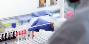 Ein Forscher arbeitet mit Blutproben unter eine Cleanbench