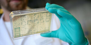 Bakterienträger im Labor und grüner Gummi- Handschuh