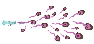 Illustriation: Spermien mit braunen Haaren und Bart kommen aus einer Spritze