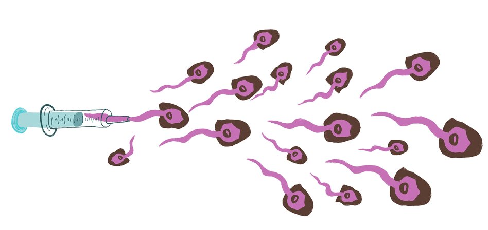 Illustriation: Spermien mit braunen Haaren und Bart kommen aus einer Spritze