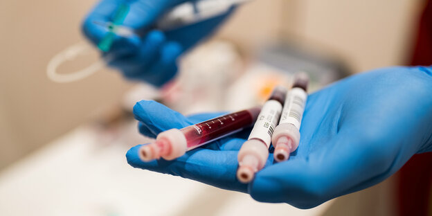 Mit Blut gefüllte Teströhrchen für einen Corona Antikörpertest