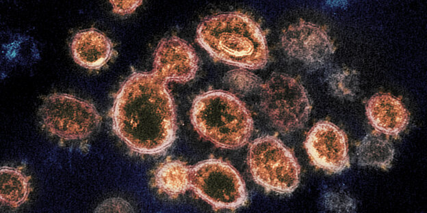 coronaviren unter dem mikroskop besehen