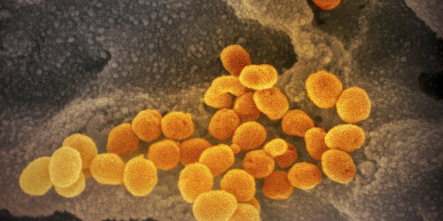 Aus einer Zelle freigesetzte Coronaviren vergrößert im Elektronenmikroskop