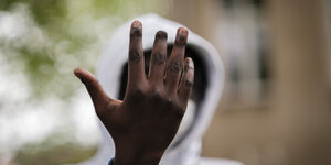 Der Schwarze Deutsche Patrick Yuma zeigt seine rechte Hand, an der eine Fingerkuppe fehlt