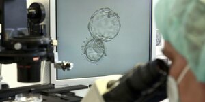 Medizinisches Fachpersonal überwacht die Befruchtung einer Eizelle unter dem Mikroskop und am Monitor