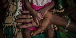 Mutter hält die Hand ihrer unterernährten Tochter in der Tigray-Region in Äthiopien