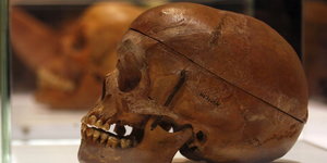 Ein menschlicher Schädel aus Namibia in der Charitè