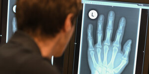 Ein Radiologe schaut sich 2018 in Friedrichshafen im Röntgenbild die linke Hand eines 17-Jährigen an.