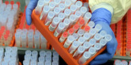 PCR Tests in Röhrchen.