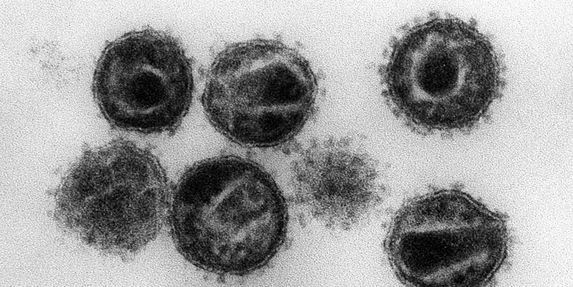 Elektromikroskopische Aufnahme von HI Viren