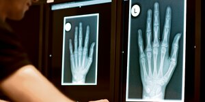 Ein Radiologe schaut sich ein Röntgenbild der linken Hand eines 13-Jährigen an.