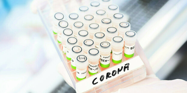 Eine biologisch-technische Assistentin zeigt aufbereitete PCR-Tests