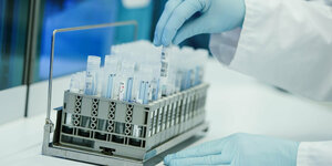 Coronatests stehen zur Auswertung in einem Labor