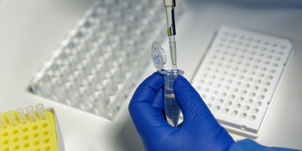 Eine Mitarbeiterin des Labors CBT füllt mit einer Pipette, zur Vorbereitung von PCR-Tests, eine Testflüssigkeit ein