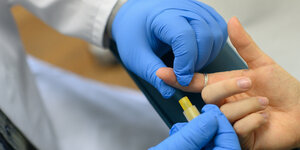 Auf dem Bild wird die Blutentnahme für einen HIV-Test im Labor demonstriert.