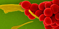 Rote Kügelchen aneinandergestreckt und gelbe Streifen auf einer grünen Fläche, Blick durchs Elektronenmikroskop